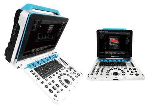 Ultrassom Portátil US30 Doppler Colorido